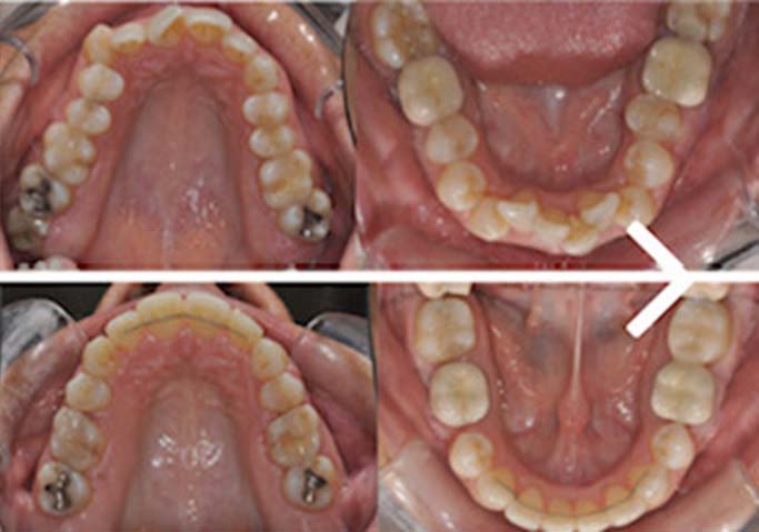 Caso clinico Ortodonzia