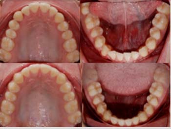 Caso clinico Ortodonzia